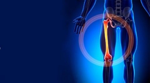 گزارش موردی درمان جوش نخوردن مزمن”نان یونیون” شکستگی استخوان ران با طب سنتی